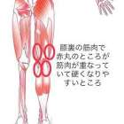 膝が痛い＝膝が悪いとは限りません｜スポーツバイクと膝痛の意外な関係